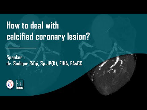 How to deal with calcified coronary lesion?
