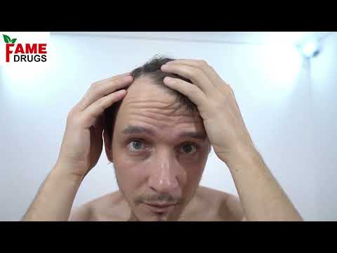 10gm fame drug herbal balkhura marham, packaging type: box