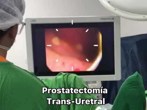 Prostatectomia Endoscópica