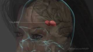 FIBROMIALGIA FISIOPATOLOGIA E SINTOMAS