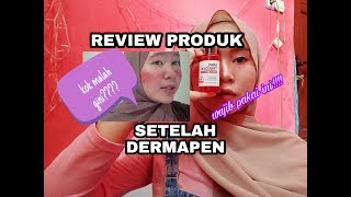 Download lagu PRODUK YG WAJIB DIPAKAI SETELAH DERMAPEN? MALAH GINI?? SNAIL TRUECICA? | ACAANISA mp3
