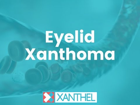 Eyelid Xanthomas