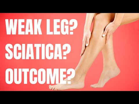 Will Leg Strength Recover after Sciatica?