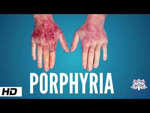 Porphyria, Causes, Signs and Symptoms, Diagnosis and Treatment.