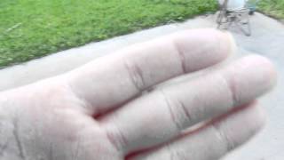 Horsehair Gordian Nematomorpha Strongyloides, or THREAD WORM Hyper-infection On Hands
