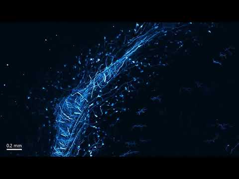 2022 09 11 125L xy cerebellum compressed