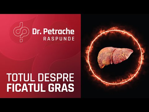 STEATOZA HEPATICA SAU FICATUL GRAS