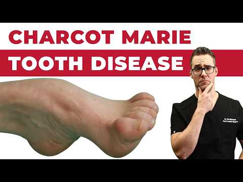 Charcot Marie Tooth Disease - Symptoms & NEW Treatments! [2024]