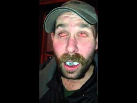 Guy take his eyes out and eats them