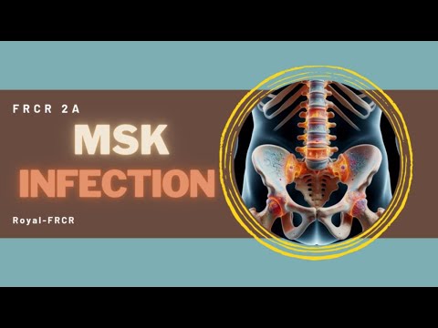 9 - MSK & Trauma Imaging for FRCR