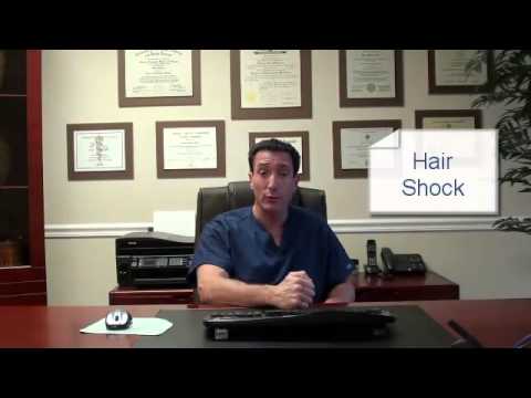 What Is Hair Transplant Shock Loss? Video