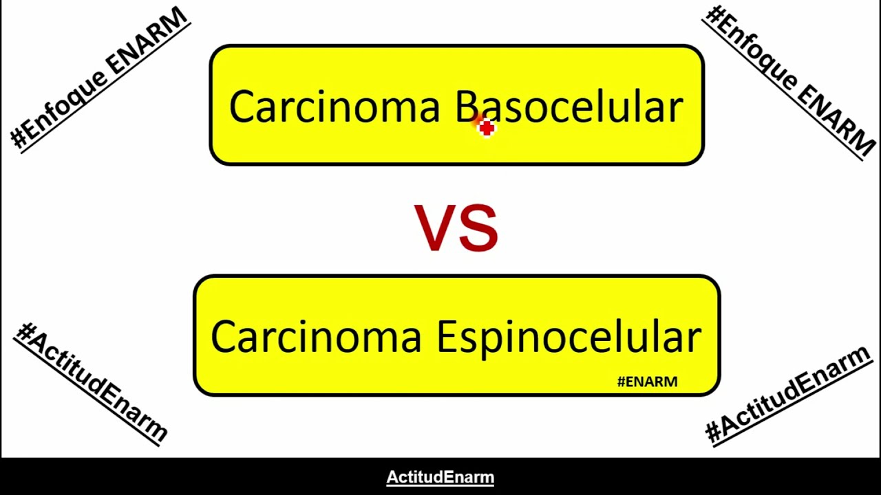 Carcinoma basocelular / Carcinoma espinocelular (ENARM)