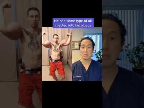 Doctor Reacts to Massive FAKE Biceps! #shorts #synthol