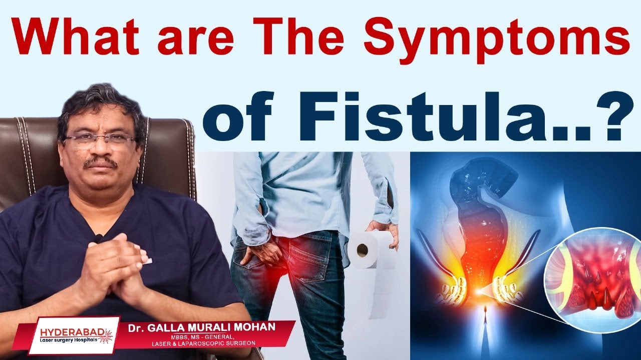 Symptoms of Fistula - Hyderabad Laser Piles Surgery