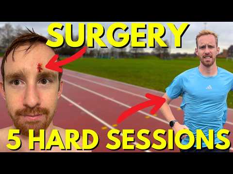 I Didn’t Stop Training for Surgery - Here’s What Happened
