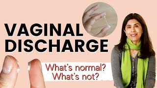 Vaginal Discharge- What