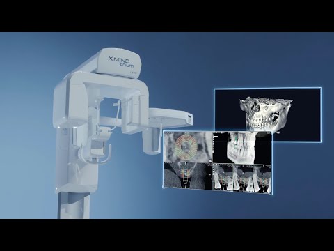 X MIND Trium Trailer