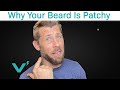 4 Things That Cause A Patchy Beard