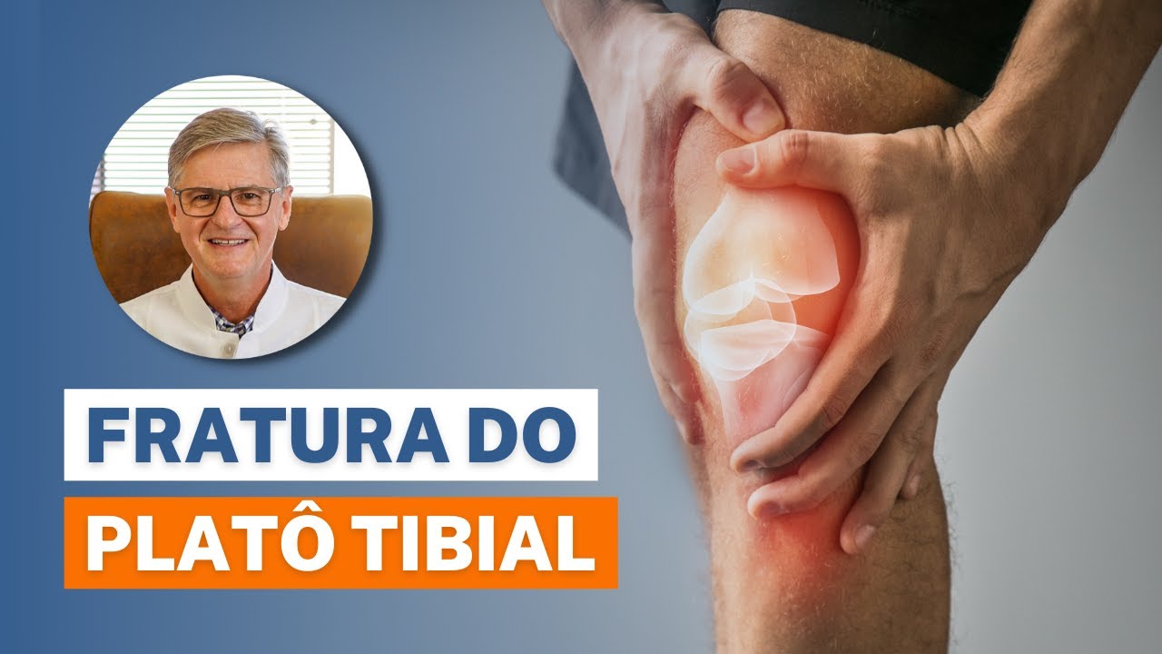 Fratura de platô tibial (Sintomas, Diagnósticos e Tratamentos)