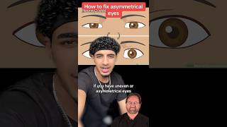 How to FIX Asymmetrical Eyes - Surgeon Reacts