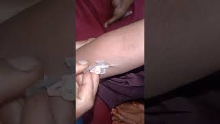 Cannulation video part 1026 #shorts #viral