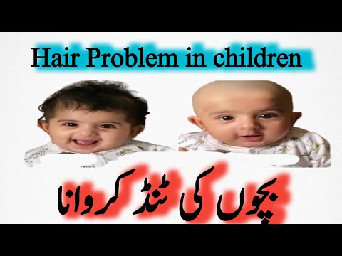 Dr.Nesreen, Bachun ki Tindd Ka maslla |Bachun k Ball na Anna |hair growth in kids