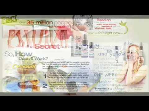 Antifungal  Nail  Treatment - Must Learn !