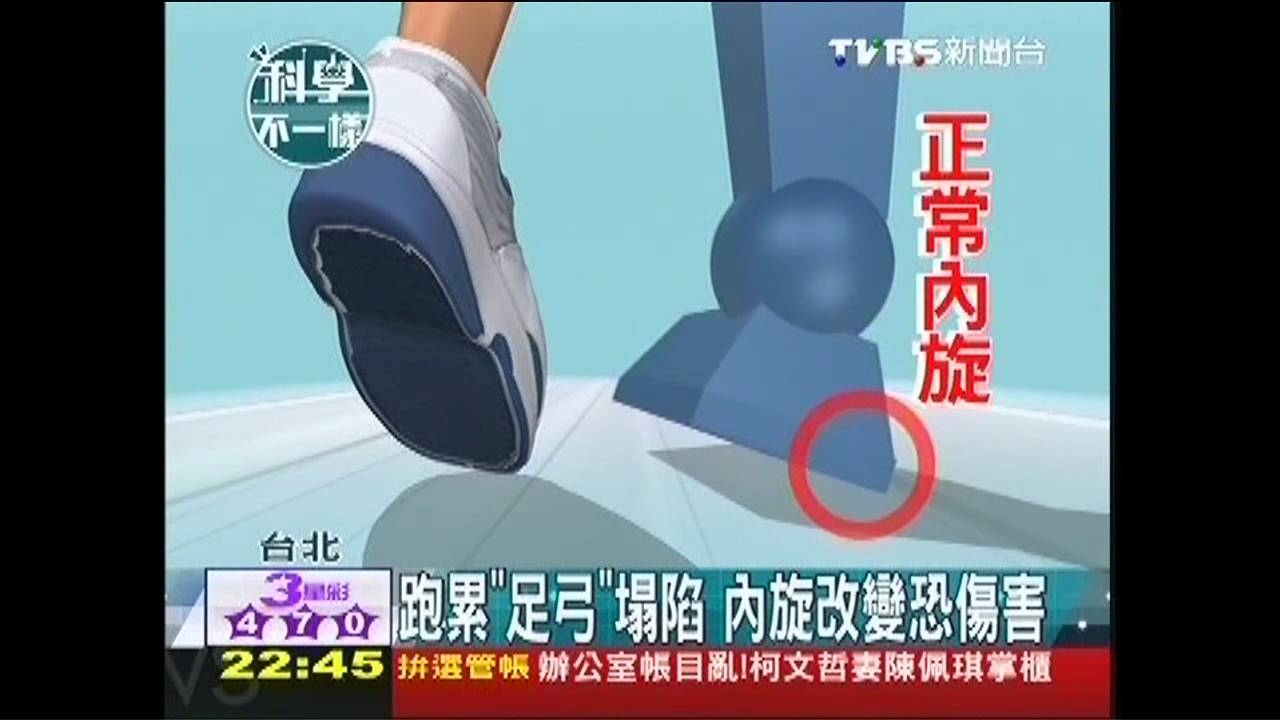 【科學不一樣】跑累「足弓」塌陷 內旋改變恐傷害