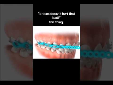 Top 5 Most PAINFUL Things About Braces! 😭🦷