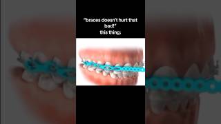 Download lagu Top 5 Most PAINFUL Things About Braces! 😭🦷 mp3