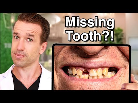 Best way to replace a MISSING TOOTH (tooth replacement options)