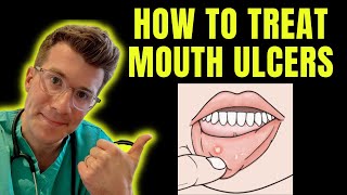 How to recognise and treat Mouth Ulcers (getting rid of canker sores) | Doctor O