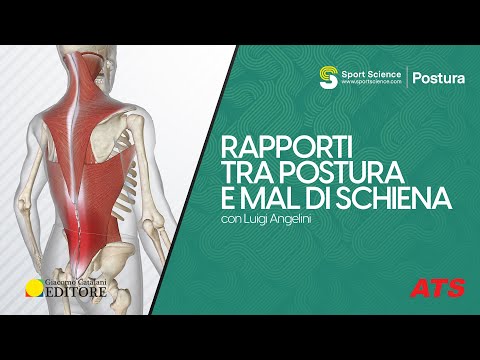 Rapporti tra POSTURA e MAL DI SCHIENA