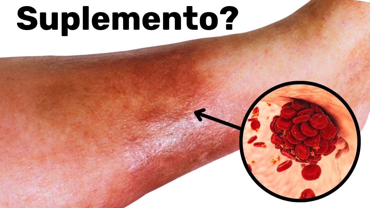 Uma colher de sopa por dia e os coágulos de sangue desaparecem para sempre!