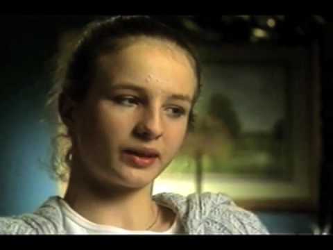 MIC-KEY 14FR Low-Profile Gastrostomy Feeding Tube kit