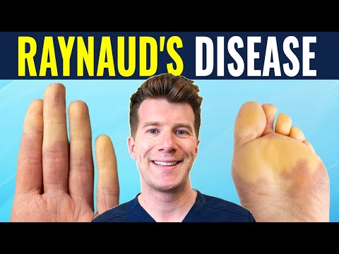 Doctor explains Raynaud's disease and syndrome | Causes, prevention and treatment