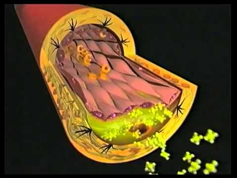 Il perossido di idrogeno pigmentary i posti può esser tolto La crema di chiarificazione per macchie scure su pelle