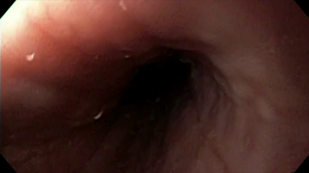 Adriana Fabiola Romano Munive-18