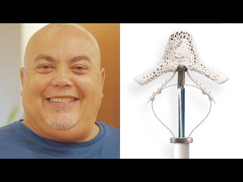 MitraClip Success Story:  After Heart Attack, David Can Dance Again (with Dr. James Thomas)