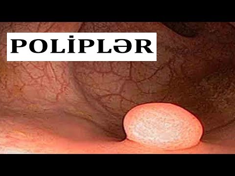 Papilloma végbélnyílás-kezelés - HPV Szemölcs
