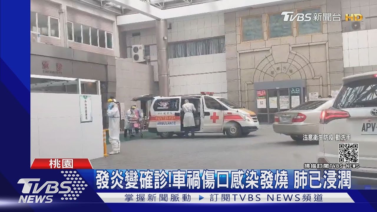 車禍傷口發炎變確診!騎士感染發燒至醫院看診 CT值17