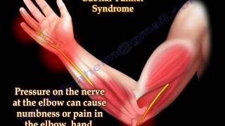 Cubital Tunnel Syndrome Ulnar Nerve Entrapment - Everything You Need To Know - Dr. Nabil Ebraheim