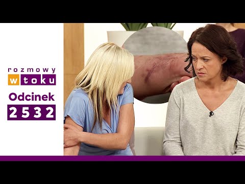 ROZMOWY W TOKU ODC. 2532