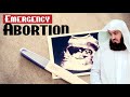 Terminating a Pregnancy in an Emergency - Mufti Menk