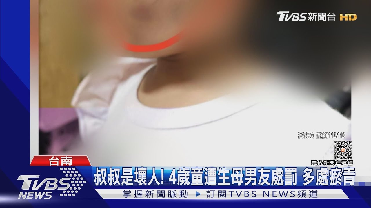 叔叔是壞人！4歲童遭生母男友處罰多處瘀青　生父怒告