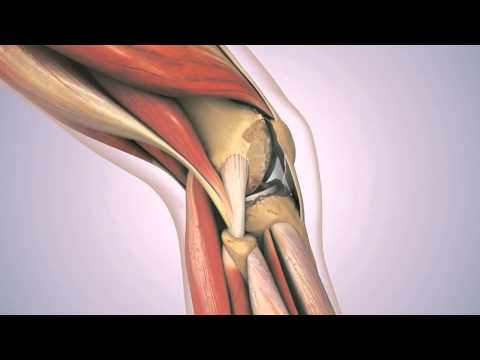 Schmerzen im Ellenbogengelenk auf der Innenseite der Gründe Wie zervikalen Osteochondrose stillende Mütter zu behandeln