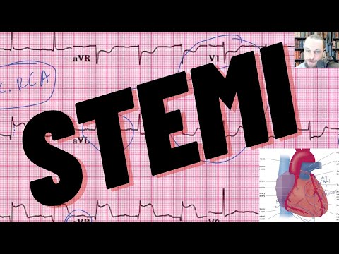 12 LEAD EKG STEMI Interpretation with Coronary Anatomy, Rx: ASA, O2, Nitro, OLMC Call Per NYC REMAC