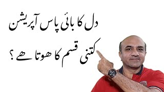 Types Of Coronary Bypass Grafting And Heart Surgery | Dr Afzal