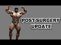 Post Gynecomastia Surgery Update + Staying motivated pt 2