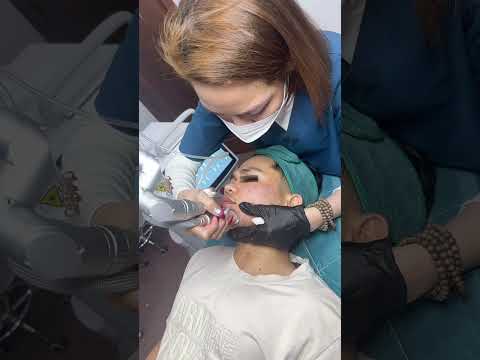 Melasma Treatment in Poipet